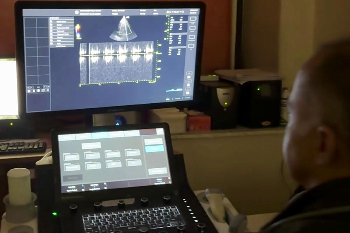 The echocardiography machine at APC