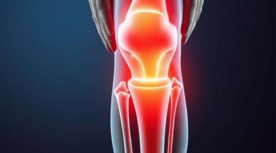 Knee Pain in Nepal: Causes, Symptoms, and Treatment